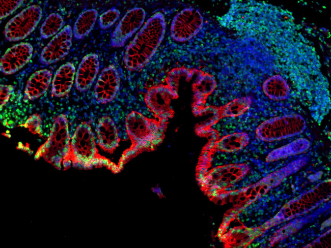 Mouse IgG (H+L) Cross-Adsorbed Secondary Antibody in Immunohistochemistry (Paraffin) (IHC (P))