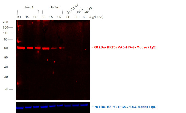 Mouse IgG (H+L) Cross-Adsorbed Secondary Antibody in Western Blot (WB)