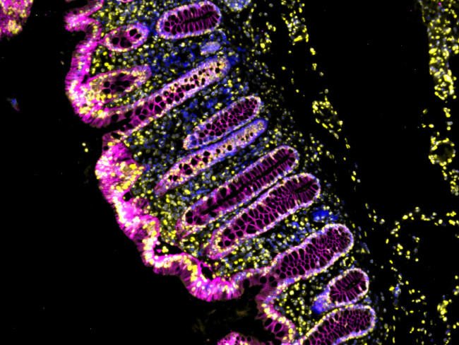 Mouse IgG (H+L) Cross-Adsorbed Secondary Antibody in Immunohistochemistry (Paraffin) (IHC (P))