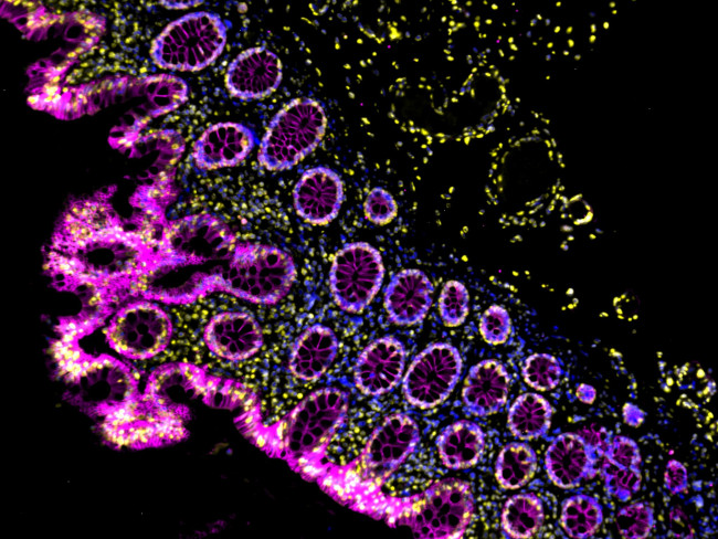 Mouse IgG (H+L) Cross-Adsorbed Secondary Antibody in Immunohistochemistry (Paraffin) (IHC (P))