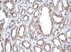 A4GNT Antibody in Immunohistochemistry (Paraffin) (IHC (P))