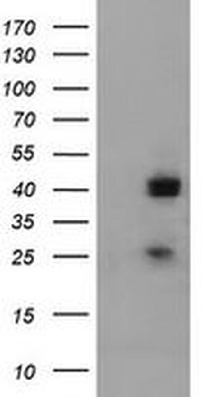 A4GNT Antibody in Western Blot (WB)