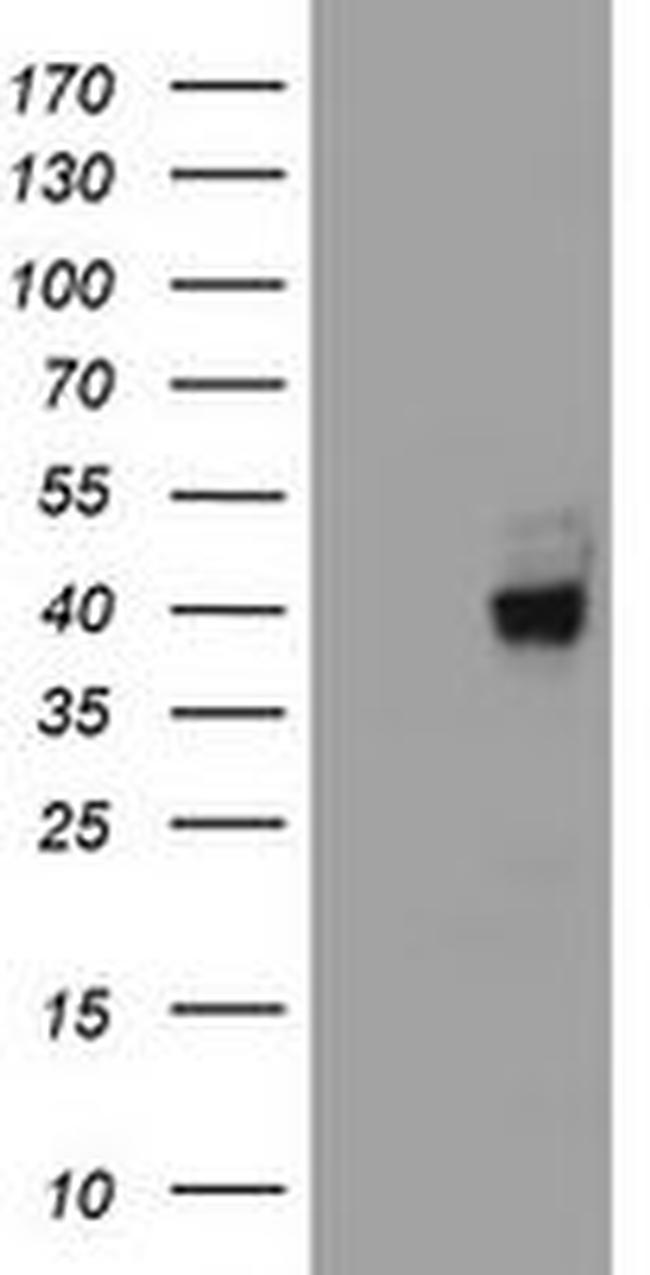 A4GNT Antibody in Western Blot (WB)