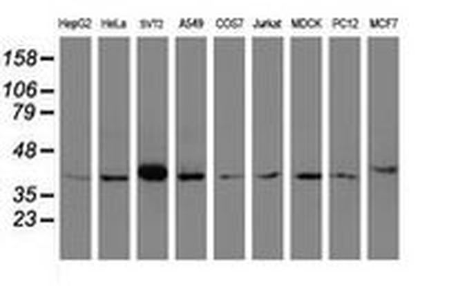 A4GNT Antibody in Western Blot (WB)