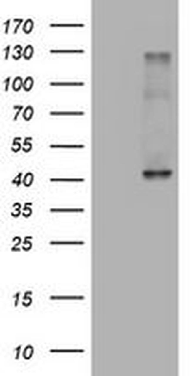 A4GNT Antibody in Western Blot (WB)