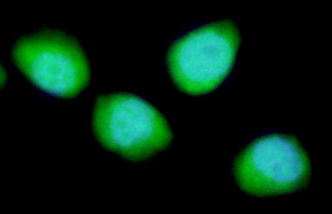 REDD1 Antibody in Immunocytochemistry (ICC/IF)