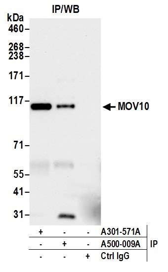 MOV10 Antibody in Immunoprecipitation (IP)