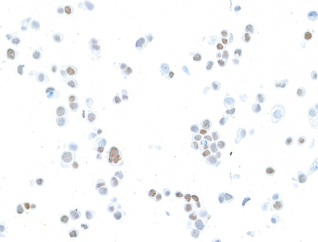 Estrogen Receptor Alpha Antibody in Immunocytochemistry (ICC/IF)