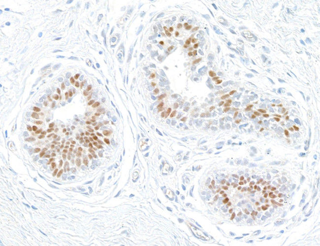 Estrogen Receptor Alpha Antibody in Immunohistochemistry (Paraffin) (IHC (P))