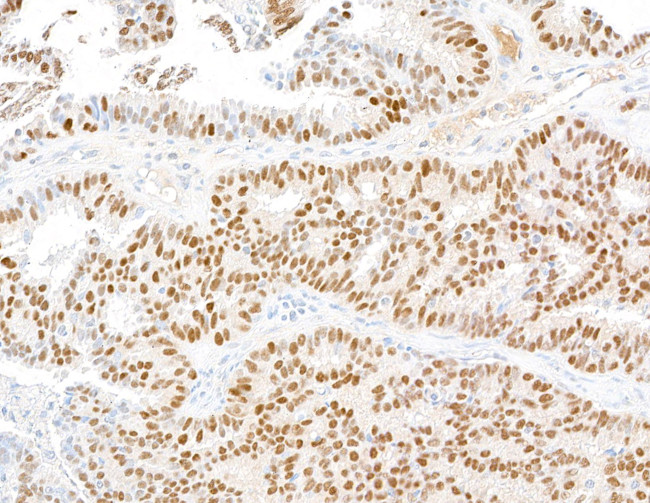 Estrogen Receptor Alpha Antibody in Immunohistochemistry (Paraffin) (IHC (P))