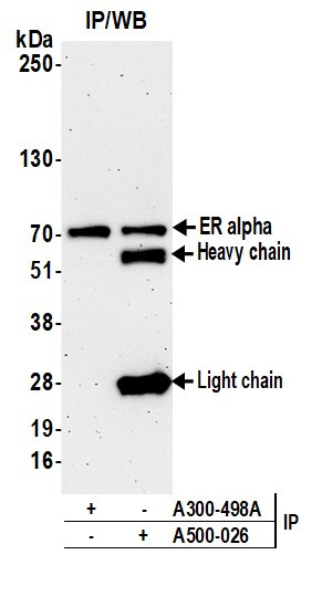 Estrogen Receptor Alpha Antibody in Immunoprecipitation (IP)