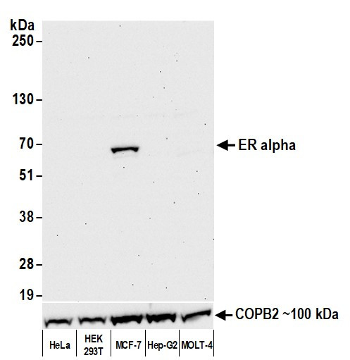 Estrogen Receptor Alpha Antibody in Western Blot (WB)