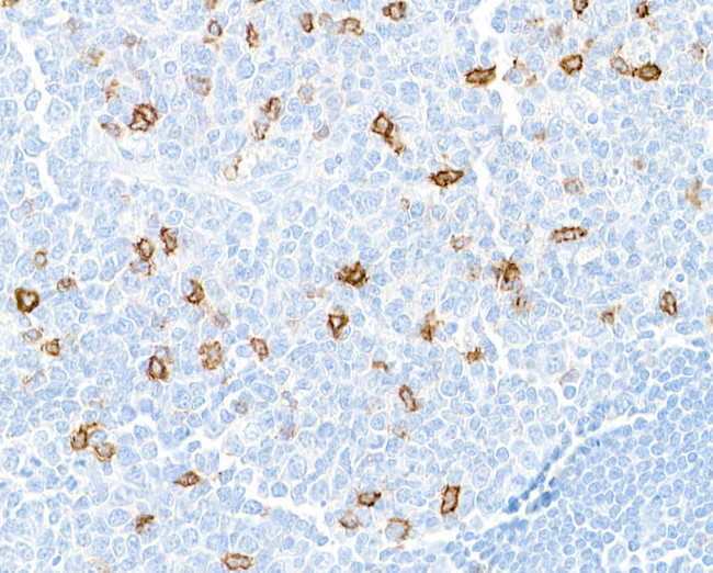 CD57 Antibody in Immunohistochemistry (Paraffin) (IHC (P))