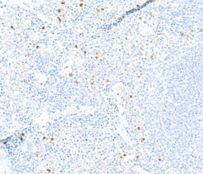 Ly-6G Antibody in Immunohistochemistry (IHC)