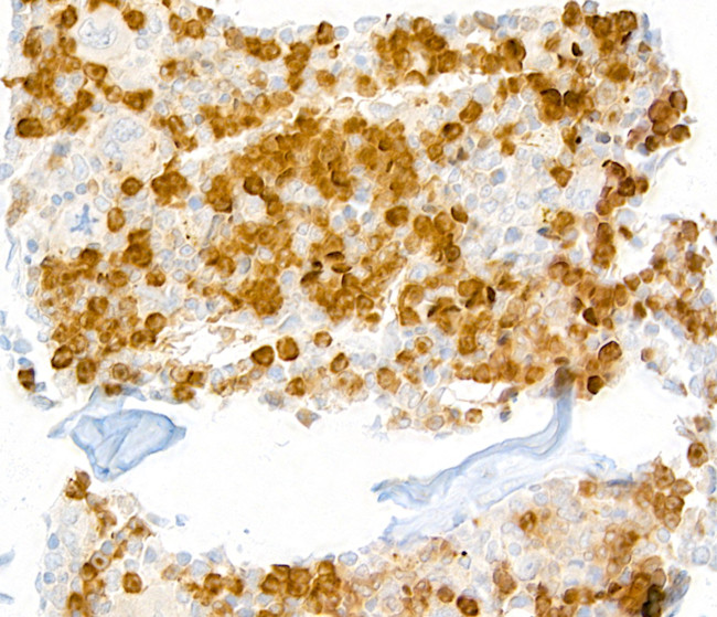 Ly-6G Antibody in Immunohistochemistry (IHC)