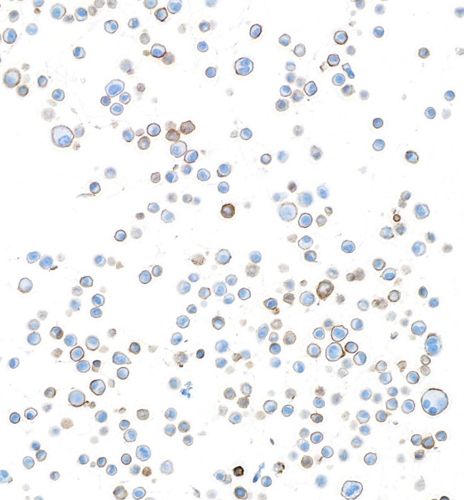 Sodium Potassium ATPase alpha-1 Antibody in Immunocytochemistry (ICC/IF)