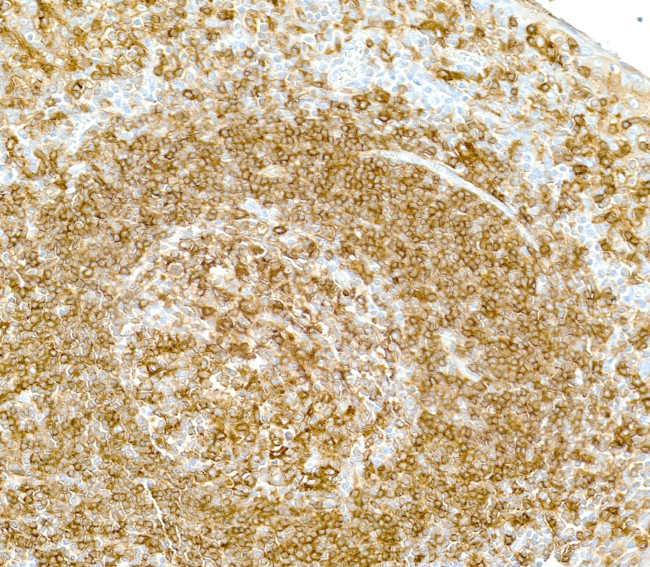 HLA-DR/DP/DQ Antibody in Immunohistochemistry (Paraffin) (IHC (P))