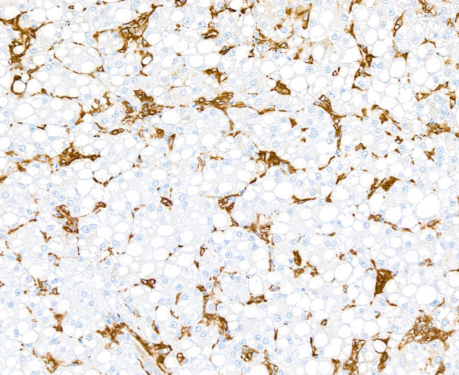 HLA-DR/DP/DQ Antibody in Immunohistochemistry (Paraffin) (IHC (P))