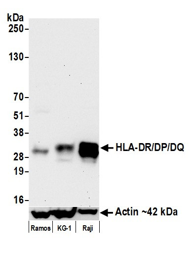 HLA-DR/DP/DQ Antibody in Western Blot (WB)