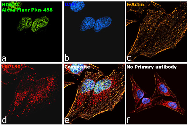 Mouse IgG (H+L) Secondary Antibody in Immunocytochemistry (ICC/IF)