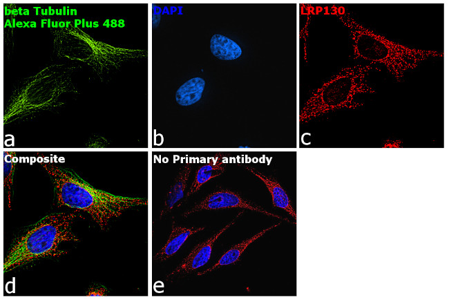 Mouse IgG (H+L) Secondary Antibody in Immunocytochemistry (ICC/IF)