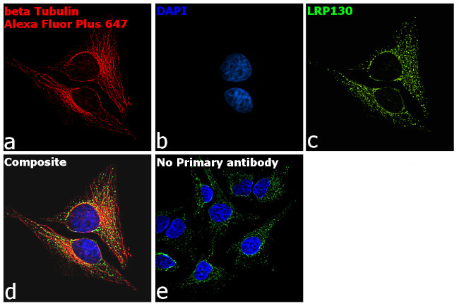 Mouse IgG (H+L) Secondary Antibody in Immunocytochemistry (ICC/IF)