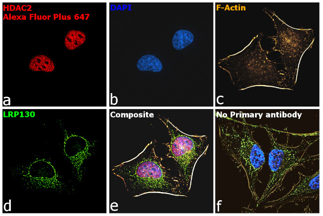 Mouse IgG (H+L) Secondary Antibody in Immunocytochemistry (ICC/IF)