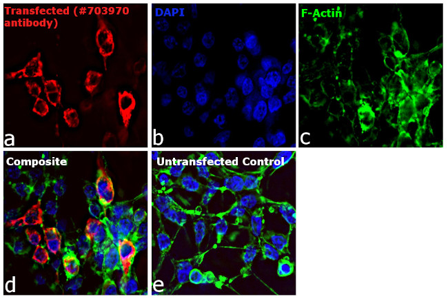 Human IgG (H+L) Secondary Antibody in Immunocytochemistry (ICC/IF)