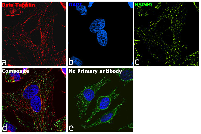 Mouse IgG Secondary Antibody in Immunocytochemistry (ICC/IF)