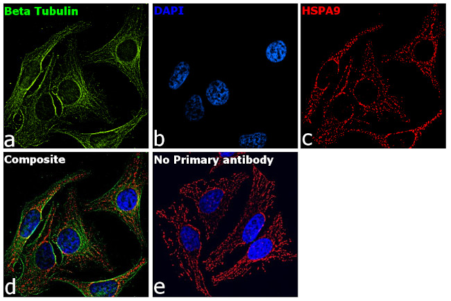 Mouse IgG Secondary Antibody in Immunocytochemistry (ICC/IF)