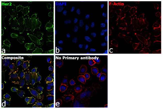 Human IgG (Light chain) Secondary Antibody in Immunocytochemistry (ICC/IF)