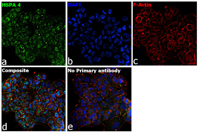 Human IgG (Lambda light chain) Secondary Antibody in Immunocytochemistry (ICC/IF)