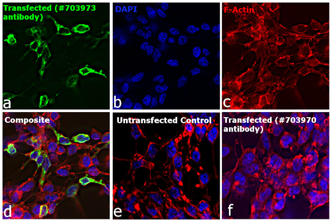 Human IgG (Lambda Light Chain) Secondary Antibody in Immunocytochemistry (ICC/IF)