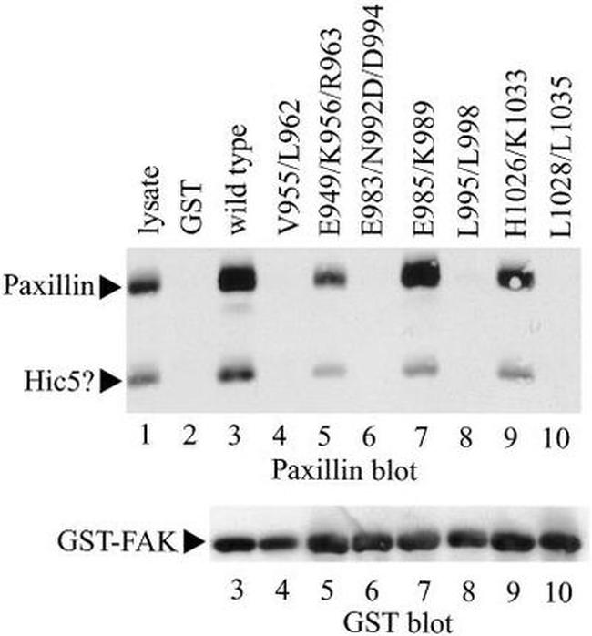 GST Tag Antibody in Western Blot (WB)