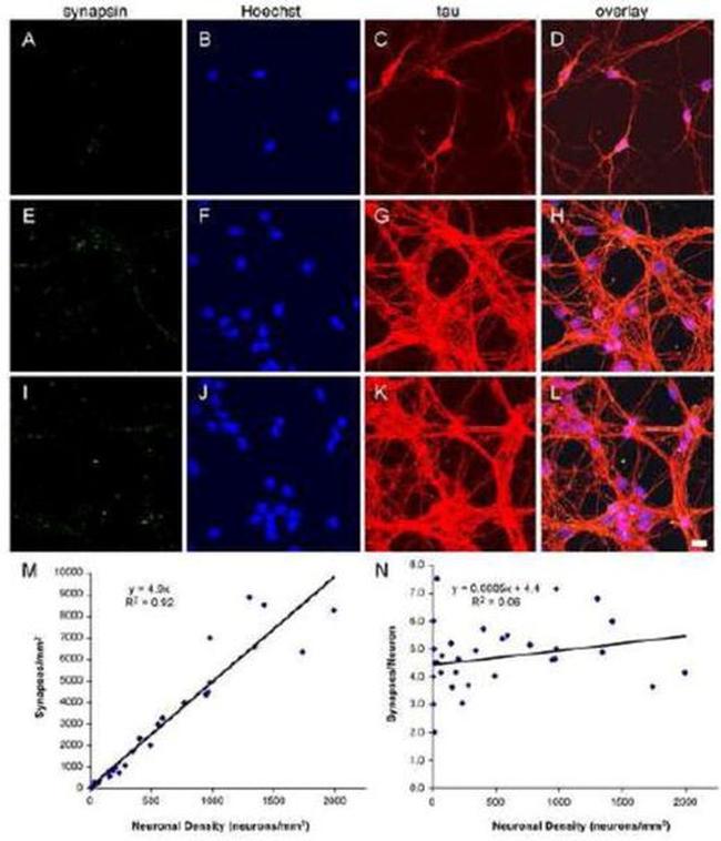 Synapsin 1 Antibody in Immunocytochemistry (ICC/IF)