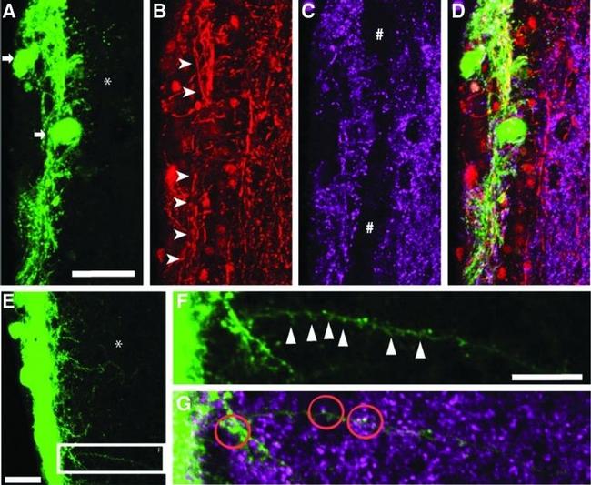 Synapsin 1 Antibody in Immunohistochemistry (IHC)