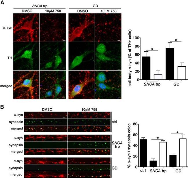 Synapsin 1 Antibody in Immunocytochemistry (ICC/IF)