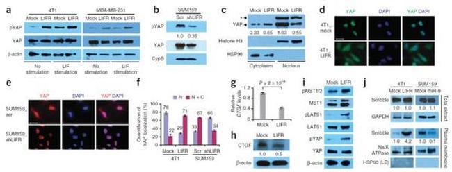 Cyclophilin B Antibody in Western Blot (WB)