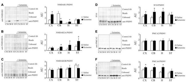 NMDAR1 Antibody in Western Blot (WB)