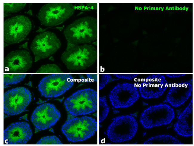 Human IgG Fc Secondary Antibody in Immunohistochemistry (Paraffin) (IHC (P))