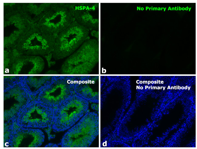 Human IgG (Heavy Chain) Secondary Antibody in Immunohistochemistry (Paraffin) (IHC (P))