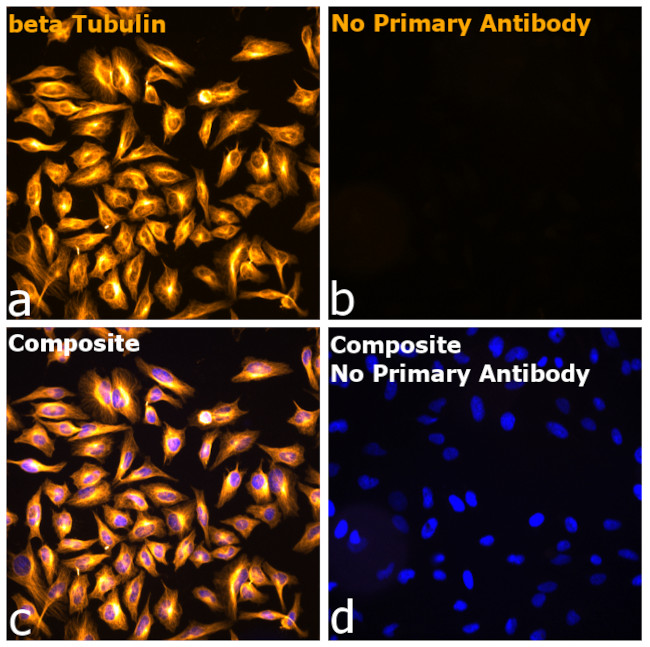 Mouse IgG1 Fc Secondary Antibody in Immunocytochemistry (ICC/IF)