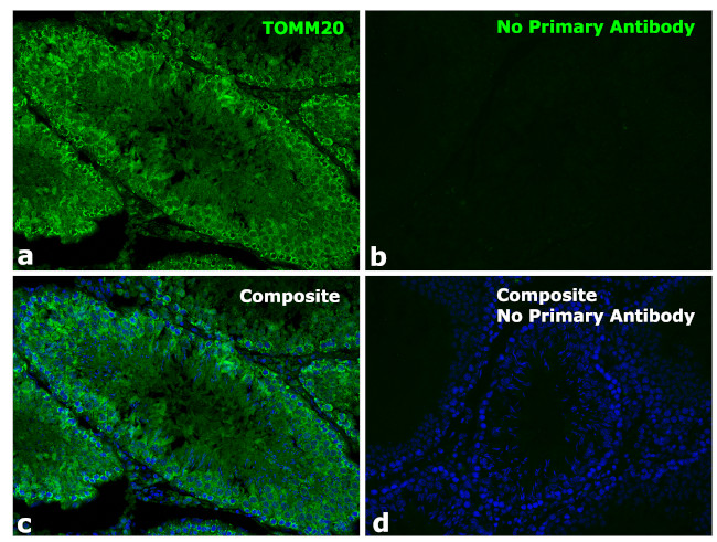 Rabbit IgG Fc Secondary Antibody in Immunohistochemistry (Paraffin) (IHC (P))