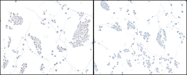 HIF2-alpha Antibody in Immunocytochemistry (ICC/IF)