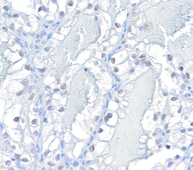 HIF2-alpha Antibody in Immunohistochemistry (IHC)