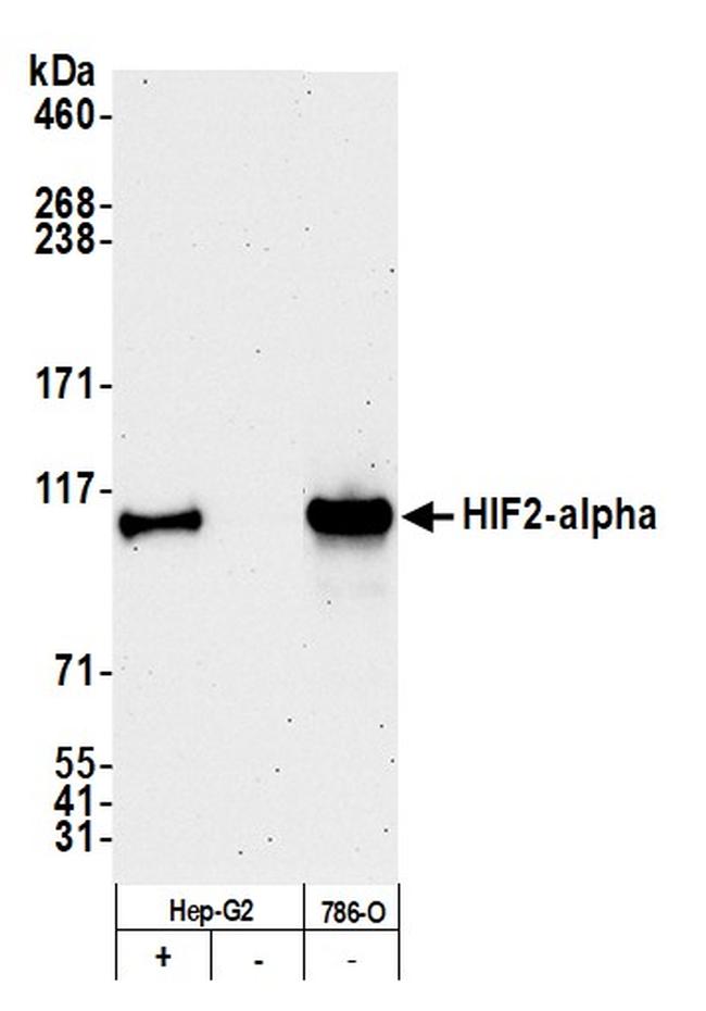 HIF2-alpha Antibody in Western Blot (WB)