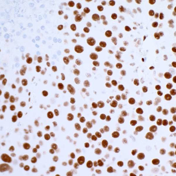 53BP1 Antibody in Immunohistochemistry (IHC)