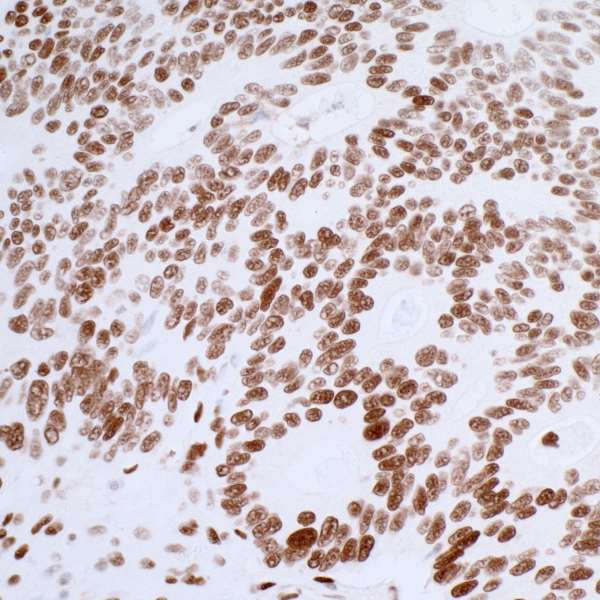 53BP1 Antibody in Immunohistochemistry (IHC)