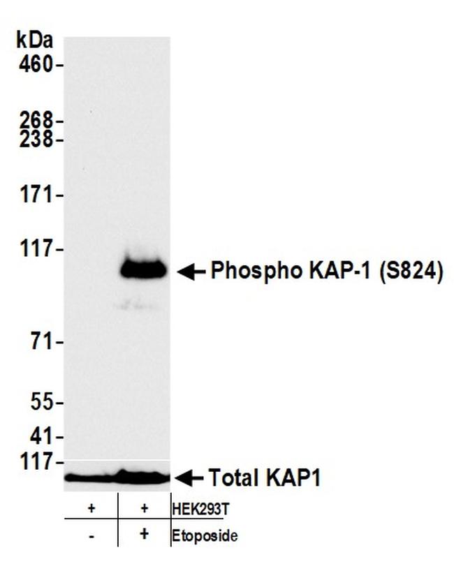 Phospho-KAP-1 (Ser824) Antibody in Western Blot (WB)