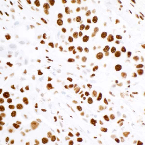 KAP-1 Antibody in Immunohistochemistry (Paraffin) (IHC (P))